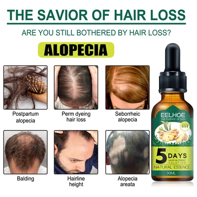 Aceite esencial para el cabello de jengibre Eelhoe. Aceite esencial para el cabello de jengibre Eelhoe.