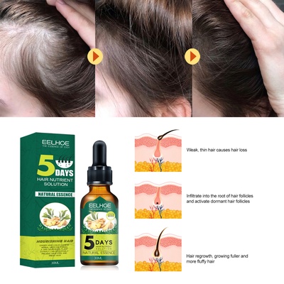 Aceite esencial para el cabello de jengibre Eelhoe. Aceite esencial para el cabello de jengibre Eelhoe.