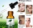 Aceite esencial de árbol de té Firstsun