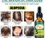 Aceite esencial para el cabello de jengibre Eelhoe. Aceite esencial para el cabello de jengibre Eelhoe.